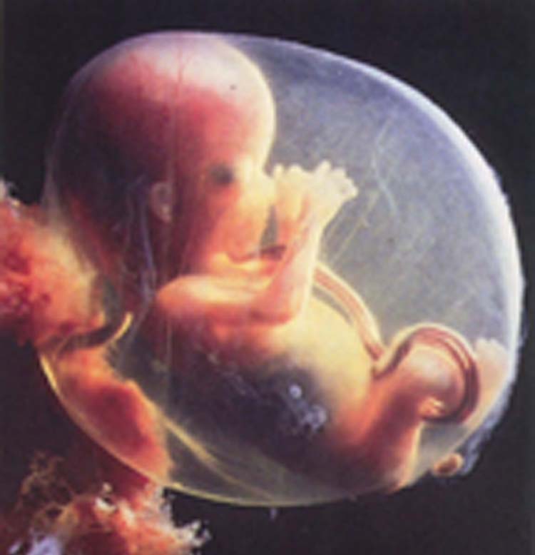 Can an unborn child be sealed to its parents?