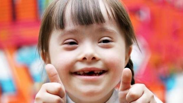 Should a person with Downs Syndrome be baptized?
