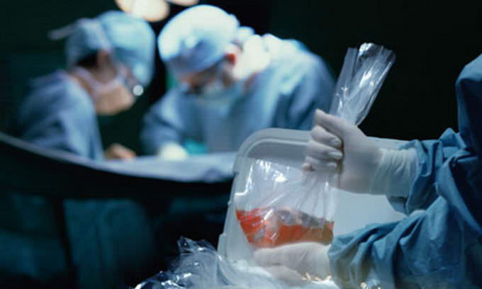 Are Mormons discouraged from donating organs?